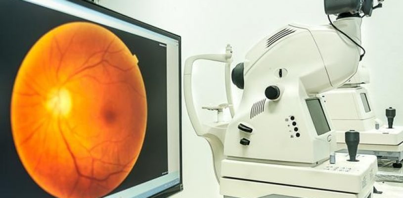 retinograf